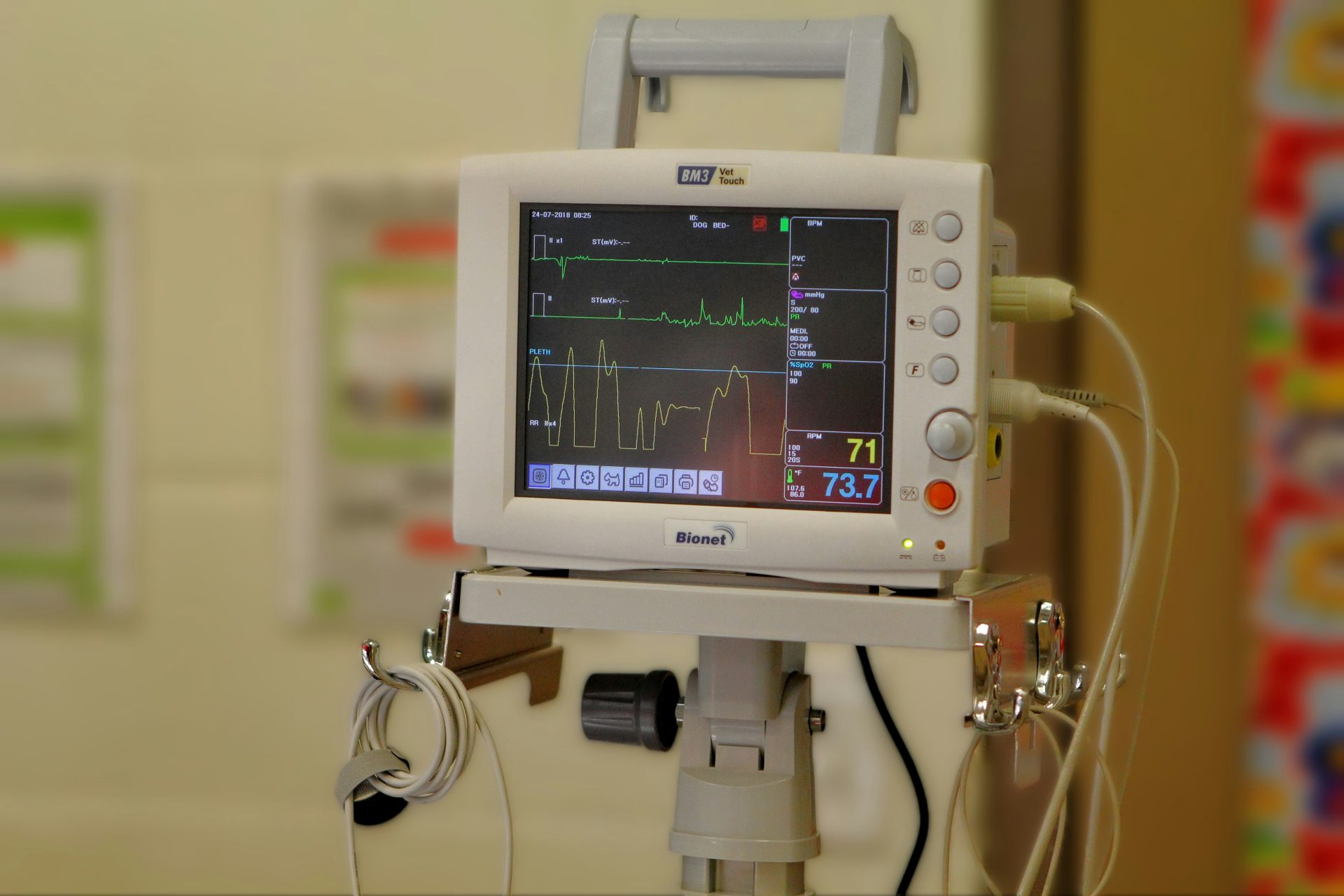 Ein Krankenzimmer mit einem Monitor auf einem Stativ